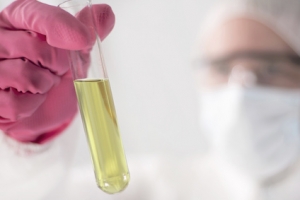 Urinalysis cancer microRNA profile urine